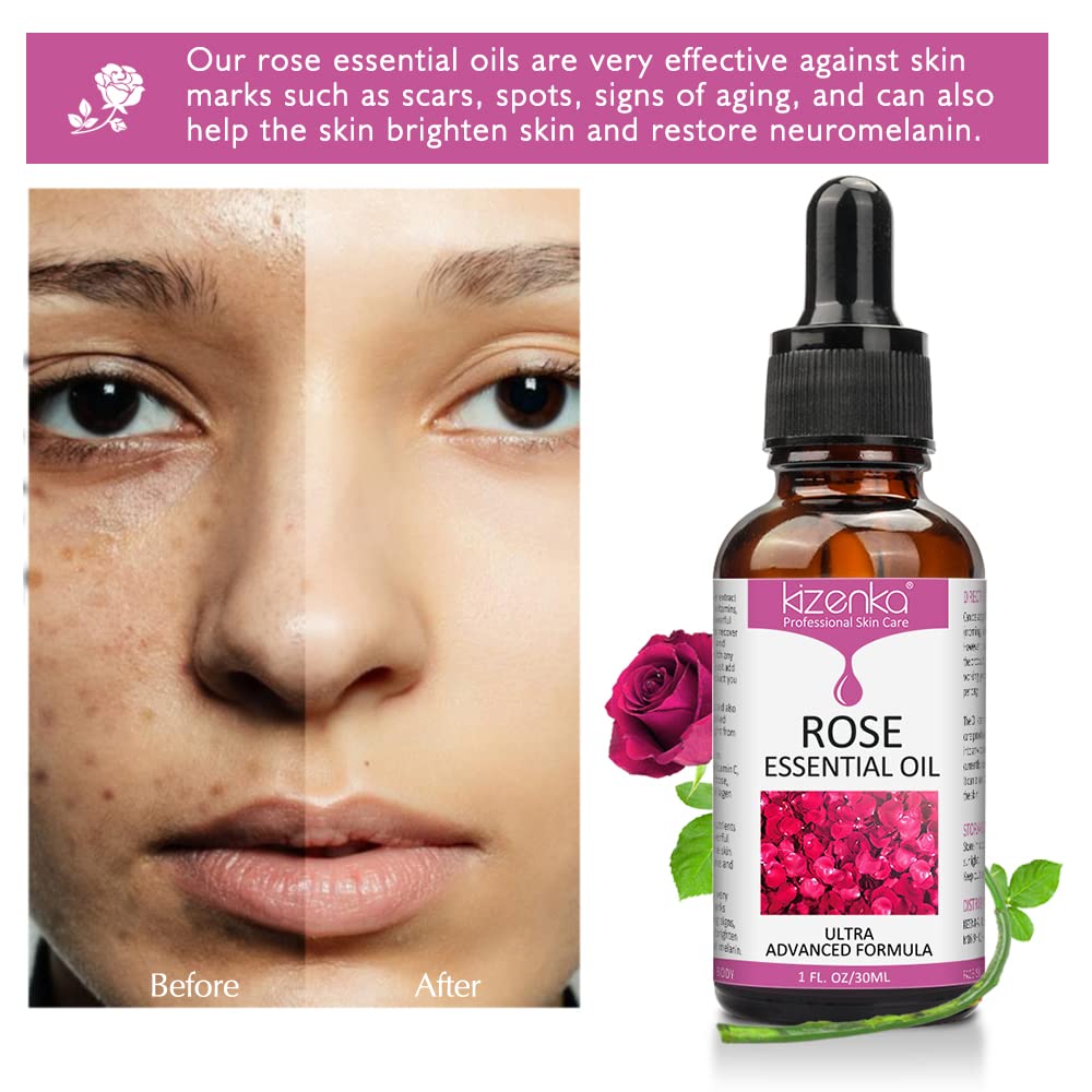 Amazon.com: 30ML Rose Essential Oil, Natural Organic Rosehip Oil